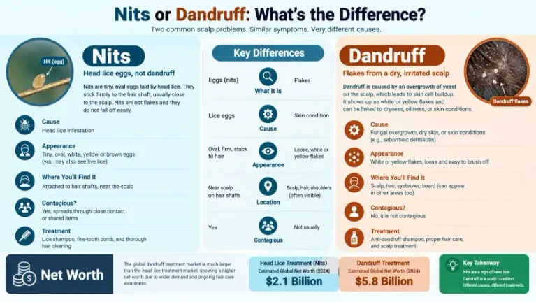 Nits or Dandruff